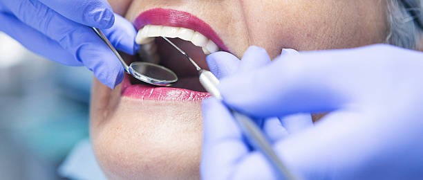 Professional Emergency Dentist in CA